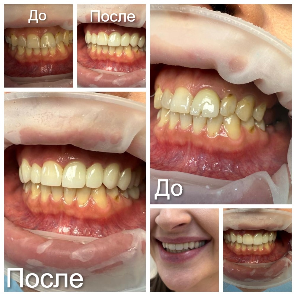 MyCollages (1).jpg MyCollages (1).jpg